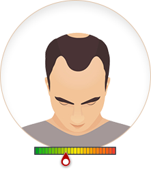 Cấp độ 3