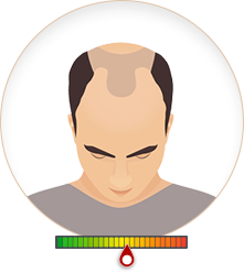 Cấp độ 4