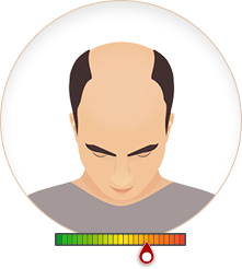 Cấp độ 5