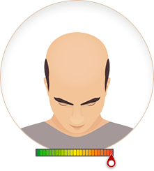 Cấp độ 1