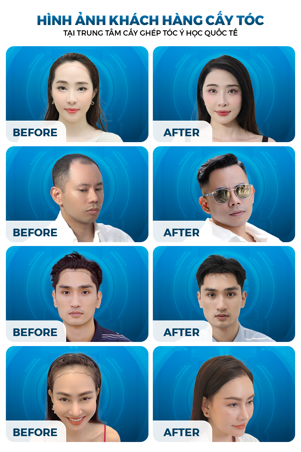 vấn đề về tóc