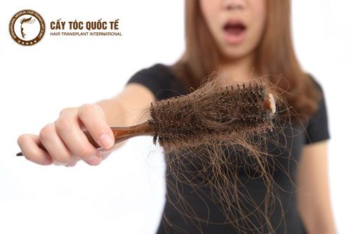 Nguyên nhân rụng tóc là gì? Nguyên nhân rụng tóc là gì?