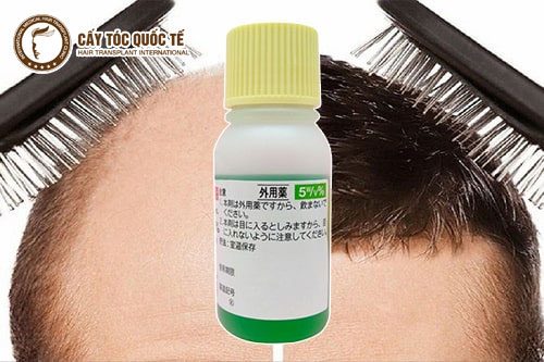 Thuốc mọc tóc Sato đạt hiệu quả ít nhiều tùy thuộc cơ địa từng người. Thuốc mọc tóc Sato đạt hiệu quả ít nhiều tùy thuộc cơ địa từng người.