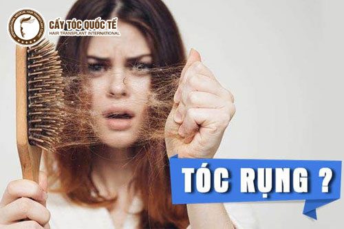Rụng tóc nhiều gây sợ hãi 