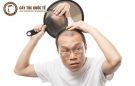 Hói đầu – Điều gì khiến nam giới lo sợ?