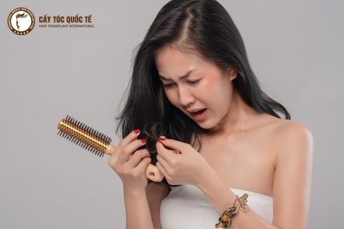 Rối loạn nội tiết cũng là nguyên nhân hói đầu sớm Rối loạn nội tiết cũng là nguyên nhân hói đầu sớm