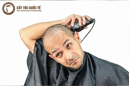 Cạo trọc là biện pháp tốt để giải quyết Bệnh Hói Bẩm Sinh Cạo trọc là biện pháp tốt để giải quyết Bệnh Hói Bẩm Sinh
