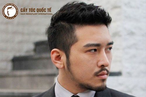 Caesar kiểu tóc ngắn che lắp giành cho người thưa tóc rất tốt Caesar kiểu tóc ngắn che lắp giành cho người thưa tóc rất tốt
