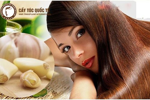 Tỏi là một nguyên liệu tốt để trị hói tóc Tỏi là một nguyên liệu tốt để trị hói tóc