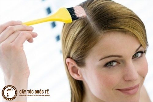 Lạm dụng hóa chất uốn nhuộm tóc quá nhiều ảnh hưởng đến da đầu cũng gây nên rụng tóc hói đầu Lạm dụng hóa chất uốn nhuộm tóc quá nhiều ảnh hưởng đến da đầu cũng gây nên rụng tóc hói đầu