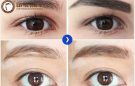 Mách bạn cách xóa sẹo lông mày cực kỳ hiệu quả