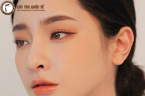 Cấy chân mày – giải pháp khắc phục khuyết điểm lông mày tối ưu nhất