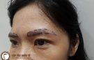 Lông mày thưa phải làm sao?