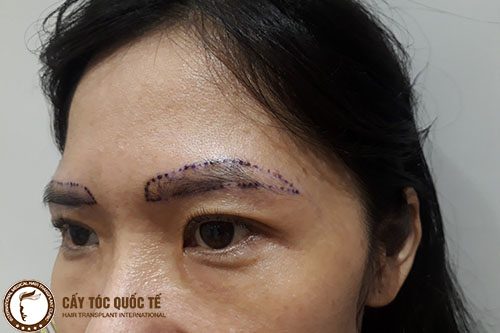 Lông mày thưa phải làm sao?